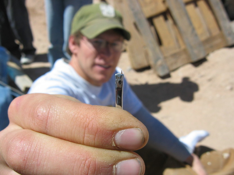 Image 67 of 168
this was in eric's foot